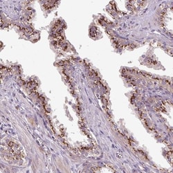 Microseminoprotein, Prostate Associated Antibody, Novus Biologicals 0.1mL;